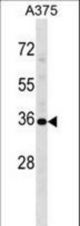 USP12 Antibody western blot of A375 cell line lysates (35 ug/lane). The USP12 antibody detected the USP12 protein (arrow).