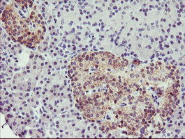 IHC of paraffin-embedded Human pancreas tissue using anti-TMOD1 mouse monoclonal antibody.