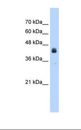 HepG2 cell lysate. Antibody concentration: 2.5 ug/ml. Gel concentration: 12%.