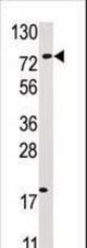 Western blot of anti-USP16 antibody in HL60 cell line lysate (35 ug/lane). USP16(arrow) was detected using the purified antibody.