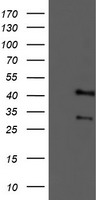 HEK293T cells were transfected with the pCMV6-ENTRY control (Left lane) or pCMV6-ENTRY TMOD1 (Right lane) cDNA for 48 hrs and lysed. Equivalent amounts of cell lysates (5 ug per lane) were separated by SDS-PAGE and immunoblotted with anti-TMOD1.