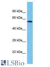 USP17L3 antibody Western Blot of Jurkat. Antibody dilution: 1 ug/ml.