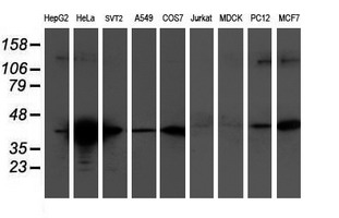 Western blot of extracts (35 ug) from 9 different cell lines by using anti-TMOD1 monoclonal antibody.