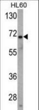 Western blot of USP2 Antibody in HL60 cell line lysates (35 ug/lane). USP2 (arrow) was detected using the purified antibody.