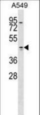 TMOD1 Antibody western blot of A549 cell line lysates (35 ug/lane). The TMOD1 antibody detected the TMOD1 protein (arrow).