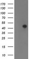 HEK293T cells were transfected with the pCMV6-ENTRY control (Left lane) or pCMV6-ENTRY TMOD1 (Right lane) cDNA for 48 hrs and lysed. Equivalent amounts of cell lysates (5 ug per lane) were separated by SDS-PAGE and immunoblotted with anti-TMOD1.