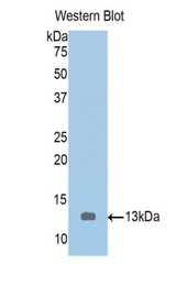 Western blot of recombinant TMOD1 / Tropomodulin 1.