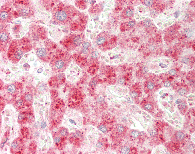 Human Liver: Formalin-Fixed, Paraffin-Embedded (FFPE)