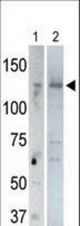 The anti-USP25 C-term antibody is used in Western blot to detect USP25 in rat testis tissue lysate (lane 1) and USP25-transfected HeLa cell lysates (lane 2). Transfection data is kindly provided by Dr. B. Pierrat from the Novartis Institute for Biomedical Research (Basel, Switzerland).