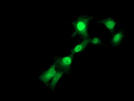 Anti-TMOD1 mouse monoclonal antibody immunofluorescent staining of COS7 cells transiently transfected by pCMV6-ENTRY TMOD1.