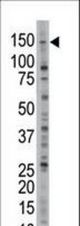 The anti-USP28 antibody is used in Western blot to detect USP28 in Jurkat cell lysate.