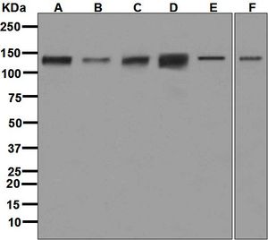 Western blot analysis on (A) 293T, (B) HeLa, (C) HT-1376, (D) human heart, (E) SW480, and (F) A431 lysates using anti-USP28 antibody.