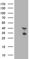 HEK293T cells were transfected with the pCMV6-ENTRY control (Left lane) or pCMV6-ENTRY TMOD1 (Right lane) cDNA for 48 hrs and lysed. Equivalent amounts of cell lysates (5 ug per lane) were separated by SDS-PAGE and immunoblotted with anti-TMOD1.