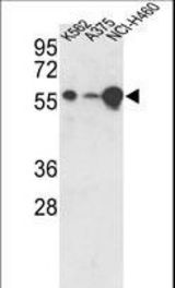 Western blot of hUSP3-Y505 in K562, A375, NCI-H460 cell line lysates (35 ug/lane). USP3 (arrow) was detected using the purified antibody.