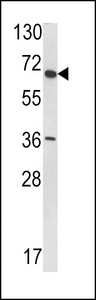 Western blot of anti-VDU1 antibody in T47D cell line lysate (35 ug/lane). VDU1(arrow) was detected using the purified antibody.
