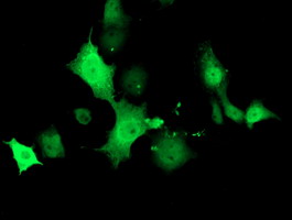 Anti-TMOD1 mouse monoclonal antibody immunofluorescent staining of COS7 cells transiently transfected by pCMV6-ENTRY TMOD1.