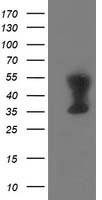 HEK293T cells were transfected with the pCMV6-ENTRY control (Left lane) or pCMV6-ENTRY TMOD1 (Right lane) cDNA for 48 hrs and lysed. Equivalent amounts of cell lysates (5 ug per lane) were separated by SDS-PAGE and immunoblotted with anti-TMOD1.