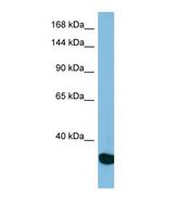 Western blot of Human HepG2. USP36 antibody dilution 1.0 ug/ml.