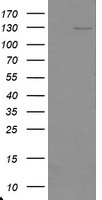HEK293T cells were transfected with the pCMV6-ENTRY control (Left lane) or pCMV6-ENTRY USP36 (Right lane) cDNA for 48 hrs and lysed. Equivalent amounts of cell lysates (5 ug per lane) were separated by SDS-PAGE and immunoblotted with anti-USP36.