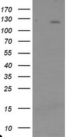 HEK293T cells were transfected with the pCMV6-ENTRY control (Left lane) or pCMV6-ENTRY USP36 (Right lane) cDNA for 48 hrs and lysed. Equivalent amounts of cell lysates (5 ug per lane) were separated by SDS-PAGE and immunoblotted with anti-USP36.