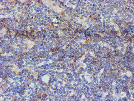 IHC of paraffin-embedded Human lymphoma tissue using anti-USP36 mouse monoclonal antibody.