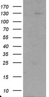 HEK293T cells were transfected with the pCMV6-ENTRY control (Left lane) or pCMV6-ENTRY USP36 (Right lane) cDNA for 48 hrs and lysed. Equivalent amounts of cell lysates (5 ug per lane) were separated by SDS-PAGE and immunoblotted with anti-USP36.