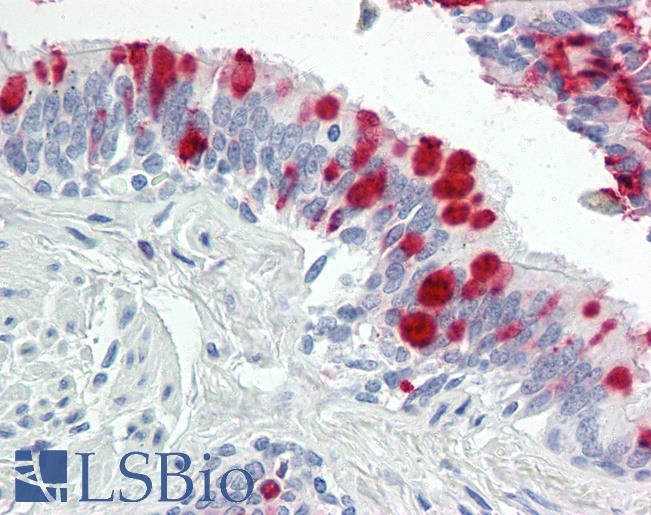 Anti-USP36 antibody IHC of human lung, respiratory epithelium. Immunohistochemistry of formalin-fixed, paraffin-embedded tissue after heat-induced antigen retrieval. Antibody LS-B8596 dilution 5 ug/ml.