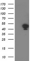 HEK293T cells were transfected with the pCMV6-ENTRY control (Left lane) or pCMV6-ENTRY TMOD1 (Right lane) cDNA for 48 hrs and lysed. Equivalent amounts of cell lysates (5 ug per lane) were separated by SDS-PAGE and immunoblotted with anti-TMOD1.