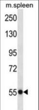 USP40 Antibody western blot of mouse spleen tissue lysates (35 ug/lane). The USP40 antibody detected the USP40 protein (arrow).