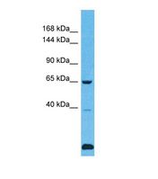 Western blot of Human Fetal Lung. USP43 antibody dilution 1.0 ug/ml.