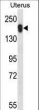 USP43 Antibody western blot of human normal Uterus tissue lysates (35 ug/lane). The USP43 antibody detected the USP43 protein (arrow).