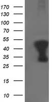HEK293T cells were transfected with the pCMV6-ENTRY control (Left lane) or pCMV6-ENTRY TMOD1 (Right lane) cDNA for 48 hrs and lysed. Equivalent amounts of cell lysates (5 ug per lane) were separated by SDS-PAGE and immunoblotted with anti-TMOD1.