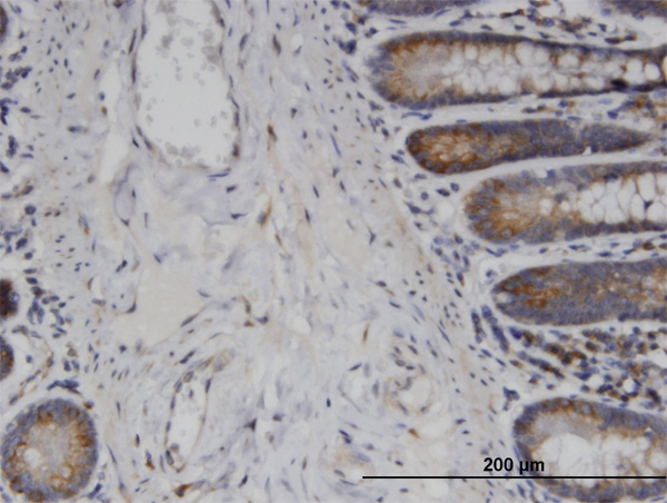Immunoperoxidase of monoclonal antibody to USP45 on formalin-fixed paraffin-embedded human small Intestine. [antibody concentration 3 ug/ml]