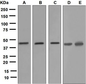 Western blot analysis on (A) human testis, (B) fetal brain, (C) SH-SY5Y, (D) Neuro-2a, and (E) C6 lysates using anti-Tropomodulin 2 antibody.