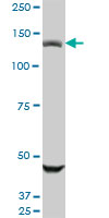 USP45 monoclonal antibody (M01), clone 1H2. Western blot of USP45 expression in A-431.
