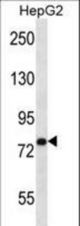 USP45 Antibody western blot of HepG2 cell line lysates (35 ug/lane). The USP45 antibody detected the USP45 protein (arrow).