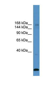 USP47 antibody LS-C135515 Western blot of ACHN lysate.