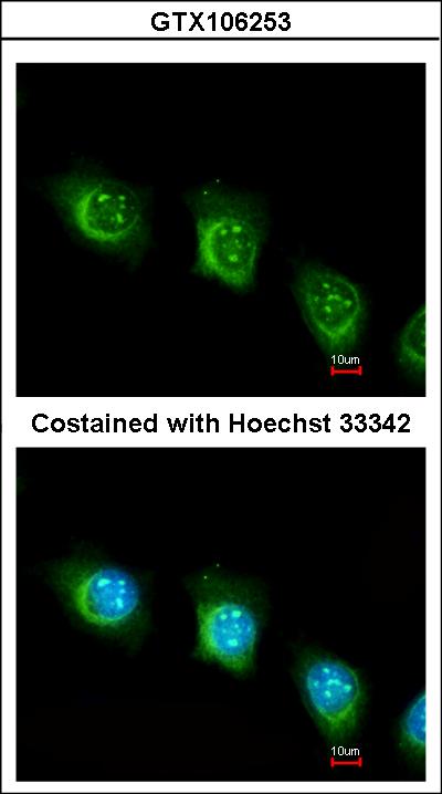 Immunofluorescence of methanol-fixed HeLa using USP47 antibody at 1:200 dilution.