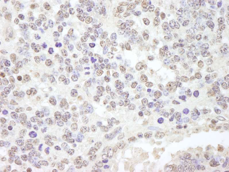 Detection of Mouse USP47 by Immunohistochemistry. Sample: FFPE section of mouse teratoma. Antibody: Affinity purified rabbit anti-USP47 used at a dilution of 1:250.