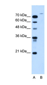 USP48 antibody LS-C40501 Western blot of HepG2 cell lysate.