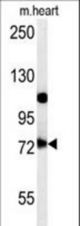 USP49 Antibody western blot of mouse heart tissue lysates (15 ug/lane). The USP49 antibody detected USP49 protein (arrow).