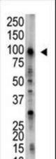 The anti-USP5 antibody is used in Western blot to detect USP5 in HL-60 cell lysate.