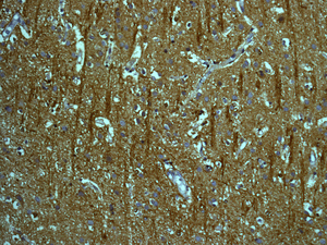 IHC of paraffin-embedded human brain tissue using anti-Tropomodulin 2 antibody.