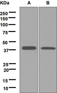 Western blot analysis on (A) fetal brain and (B) SH-SY5Y cell lysates using anti-Tropomodulin 2 antibody.