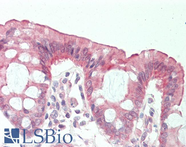 Anti-TMOD3 / Tropomodulin 3 antibody IHC staining of human colon. Immunohistochemistry of formalin-fixed, paraffin-embedded tissue after heat-induced antigen retrieval. Antibody LS-B11027 concentration 20 ug/ml.