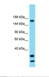 Western blot of Human THP-1 . USP54 antibody dilution 1.0 ug/ml.