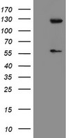 HEK293T cells were transfected with the pCMV6-ENTRY control (Left lane) or pCMV6-ENTRY USP54 (Right lane) cDNA for 48 hrs and lysed. Equivalent amounts of cell lysates (5 ug per lane) were separated by SDS-PAGE and immunoblotted with anti-USP54.