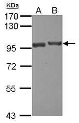 Sample (30 ug of whole cell lysate) A: A431 B: Jurkat 7.5% SDS PAGE USP6NL antibody diluted at 1:1000