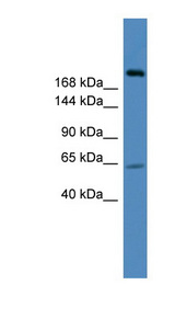 USP9X antibody LS-C116832 Western blot of 293T cell lysate.
