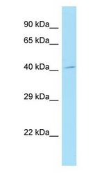 TMOD4 / Tropomodulin 4 antibody Western Blot of HT1080.